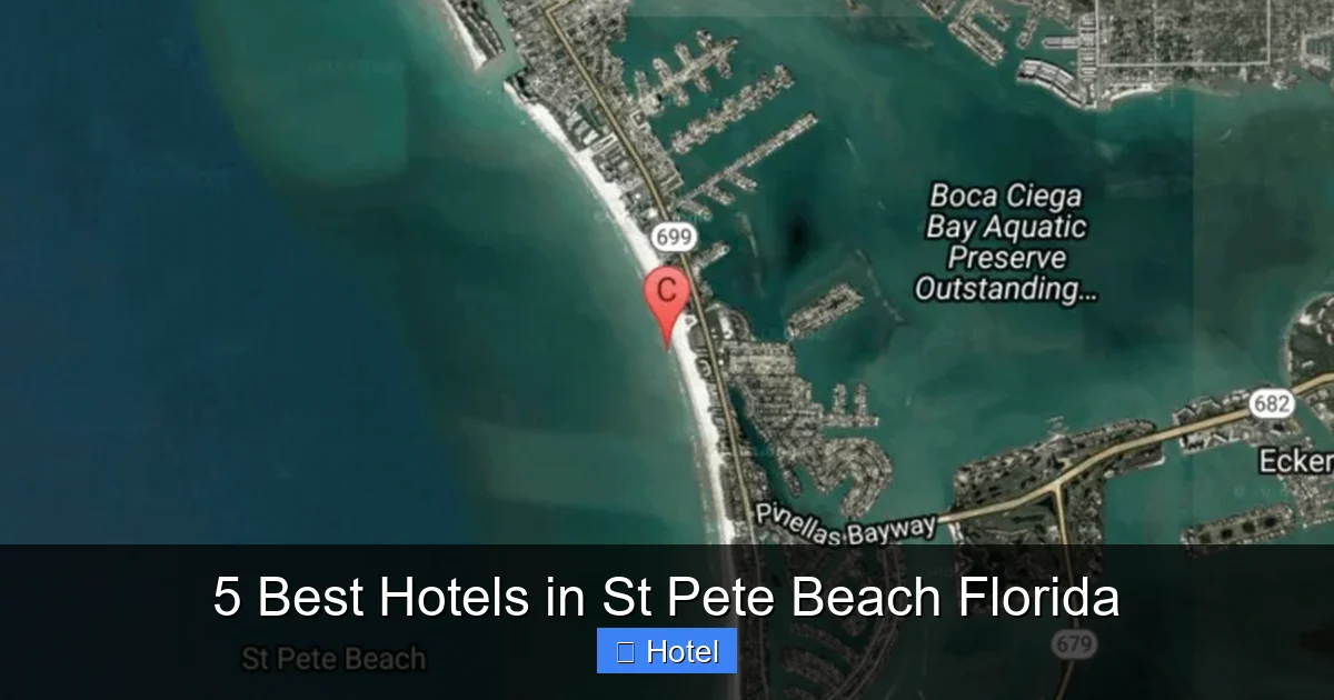5 Best Hotels in St Pete Beach Florida