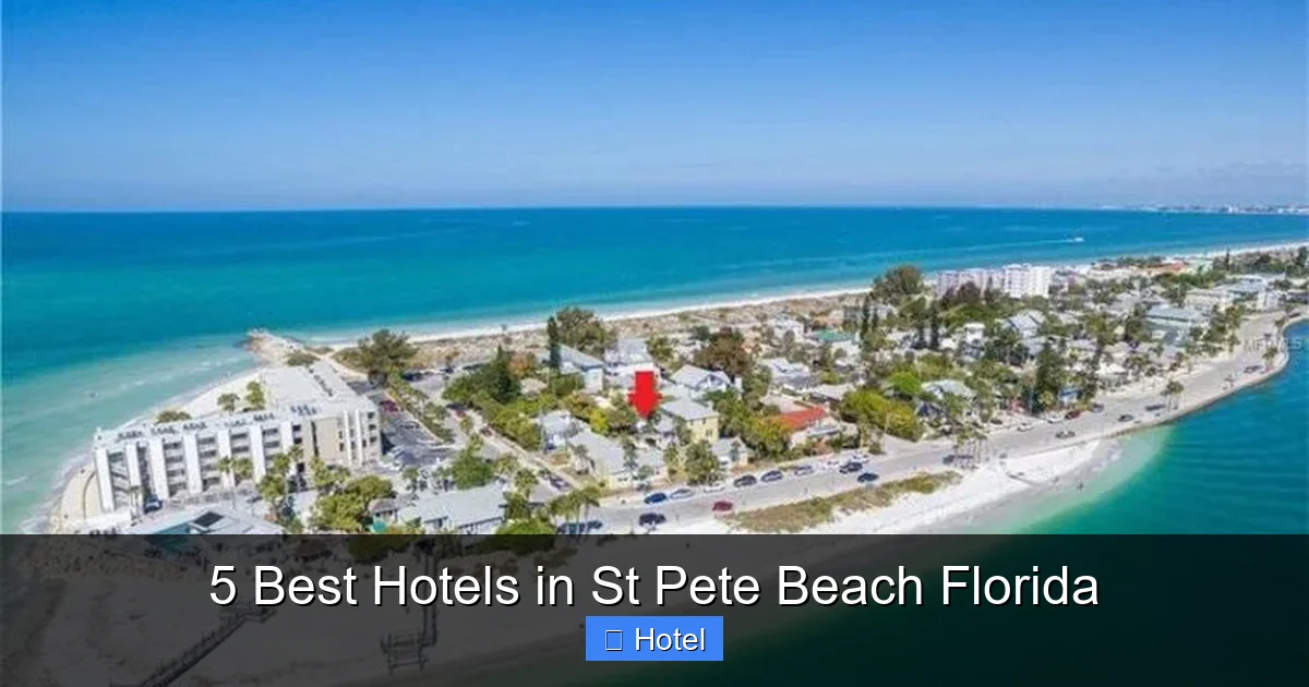 5 Best Hotels in St Pete Beach Florida