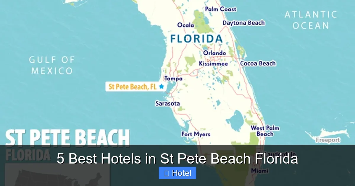 5 Best Hotels in St Pete Beach Florida